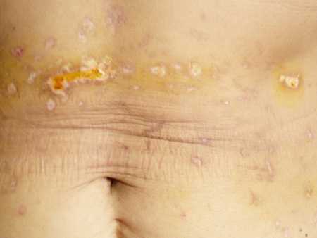 Chữa bệnh bằng chích nhang, đá vào vùng kín