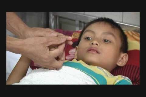 Đi chơi, bị rắn cực độc cắn suýt chết