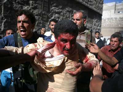 Video: Kinh hoàng phiến quân tra tấn lính Syria