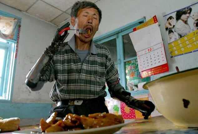 Mất 8 năm để tự tạo đôi tay giả sau tai nạn nổ mìn