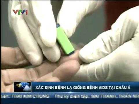 Bệnh lạ ở Châu Á giống bệnh AIDS