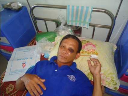 Thanh Hóa: Trưởng thôn đánh dân nhập viện