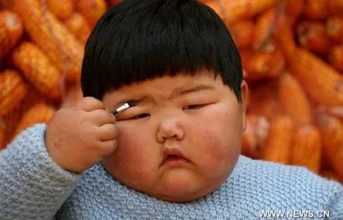 Béo phì trẻ em: Có nên thắt dạ dày, bóc mỡ?