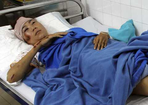Nữ hoàng điền kinh VN bị xe đâm gãy chân