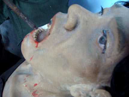 Vồ sầu đời, gậy biệt ly và kỹ nghệ đục răng tàn bạo