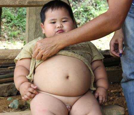 Viện Nhi Trung ương mời bé 'khổng lồ' xuống khám