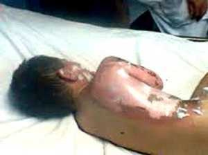 Rơi xuống ao cá, bé đang tập đi tử vong