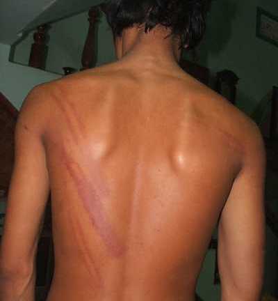 Kỷ luật Trưởng công an xã đánh dân dã man