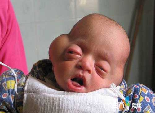 Cận cảnh bé trai mắt ‘ếch’ và có… đuôi