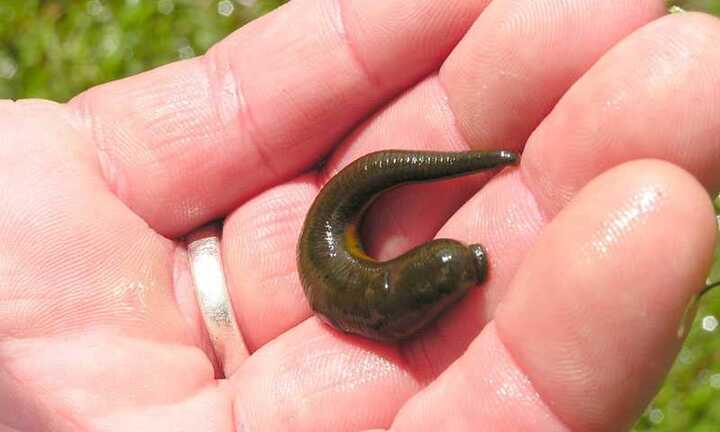 Uống sữa đỉa bâu đầy răng: Công an, chuyên gia nói gì?