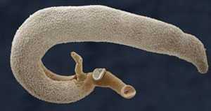 Phát hiện sán lá dài 6cm sống ký sinh dưới da