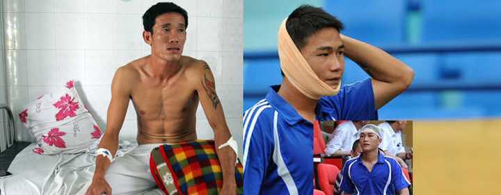 Những cầu thủ Việt bỗng dưng bị côn đồ... thăm hỏi