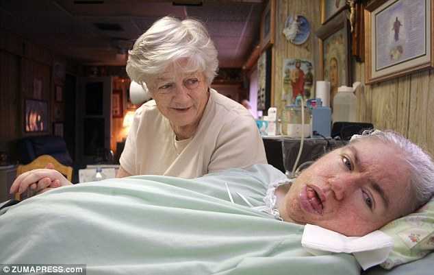 Người phụ nữ hôn mê 42 năm đã qua đời