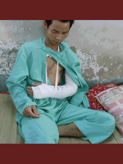 TP.HCM: Xông vào tận nhà chặt tay cướp điện thoại