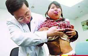 Bé gái sở hữu làn da nửa đen nửa trắng