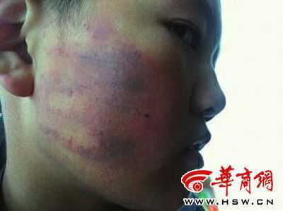 Trung Quốc: Cô giáo xui 50 học sinh tát bạn cùng lớp