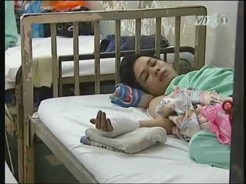 TP.HCM: Một ngày 10 người bị cướp giật đâm chém