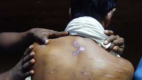 Hé lộ đường dây buôn người ở Thái Lan