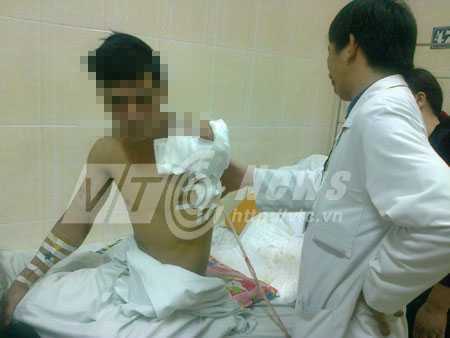 Máy cán thép nghiền nát cánh tay, dập nửa người