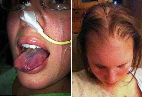 Tắm nắng, một phụ nữ suýt chết