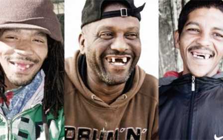 Kỳ quặc 'mốt' nhổ răng cửa để... tán gái