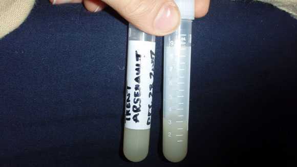 Chấn động vụ kiện hiến tinh trùng hi hữu