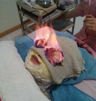 Kinh dị màn làm đẹp bằng cách đốt mắt cháy rừng rực