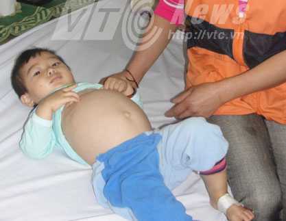 'Đau đớn quá, bệnh này em tưởng chỉ có trong phim Hàn'