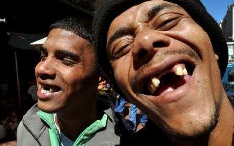 Quái gở mốt nhổ sạch răng cửa cho… hấp dẫn phụ nữ