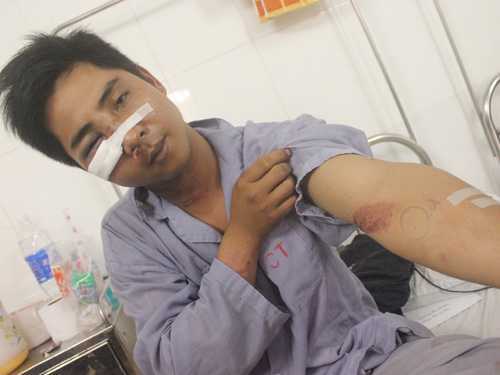 Đình chỉ cảnh sát tổ 141 bị 'tố' đánh dân để điều tra