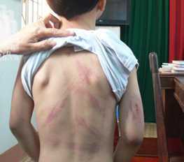 Đánh đập dã man con trai 7 tuổi vì quên lịch thi