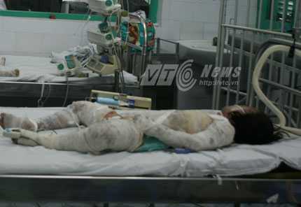 Nghi can thiêu sống cả nhà đã tử vong