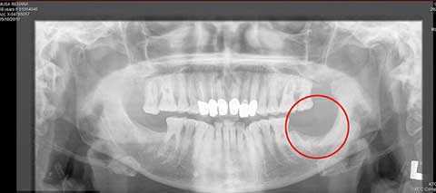 Lỡ nhổ 1 chiếc răng, bác sĩ mất 2 tỷ đồng