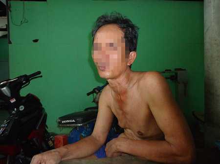 Hàng loạt người đang khỏe, không tệ nạn bỗng mắc HIV