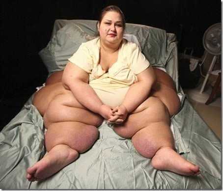 Những chuyện bi hài bởi… quá béo