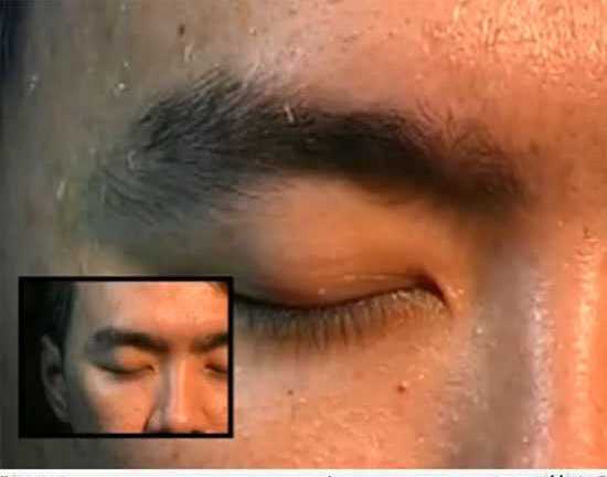 Clip: Rùng mình chữa bệnh bằng giòi sống