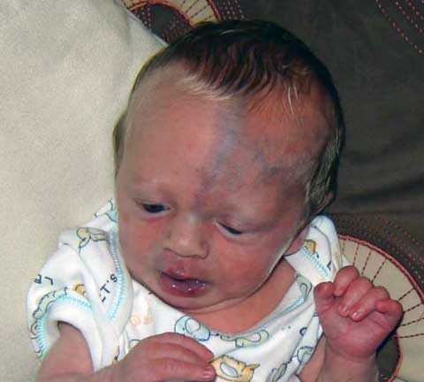 Cậu bé có thể mất mạng mỗi khi buồn ngủ