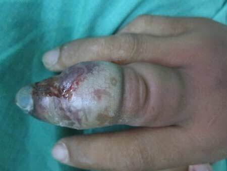 Kinh hãi, heo cắn gây tử vong