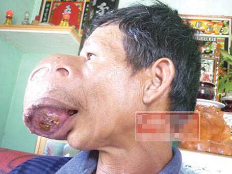 Đau xót lão nông nghèo mang khuôn mặt tê giác