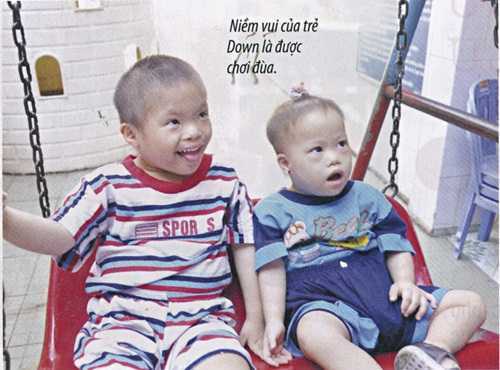 Phó Giáo sư nói cách tránh nguy cơ sinh con Down