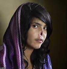 Thương xót cô gái xinh đẹp bị chồng cắt mũi, xẻo tai