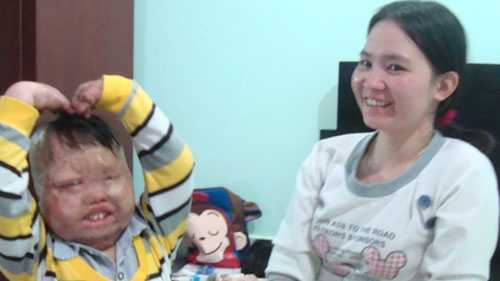 Cậu bé bị bố đốt và hành trình tìm lại tuổi thơ