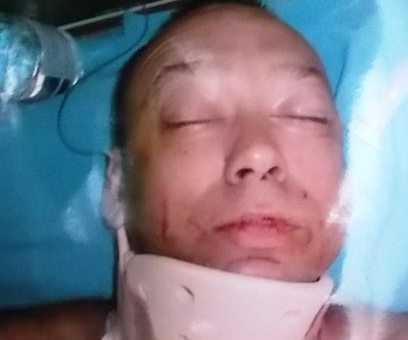 Hai du khách Nga choảng nhau, kẻ chết người bỏ trốn