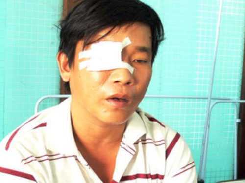 Cãi vã với mẹ, đâm thủng mắt con
