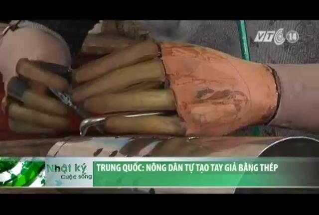 Clip: Gặp người nông dân có đôi tay 'Người sắt'