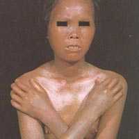 Quý bà thất kinh vì 'hóa đá'