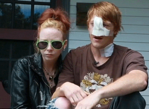 Bảo vệ bạn gái, bị chó cắn đứt mũi