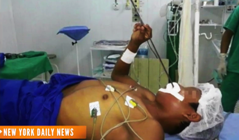 Xót xa thiếu niên bị xiên cá bắn xuyên đầu