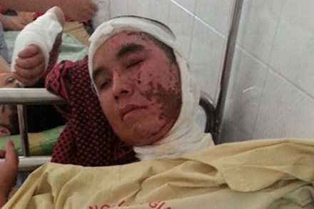 Người vợ tạt axit từng dọa 'xử' cả nhà chồng bằng mìn