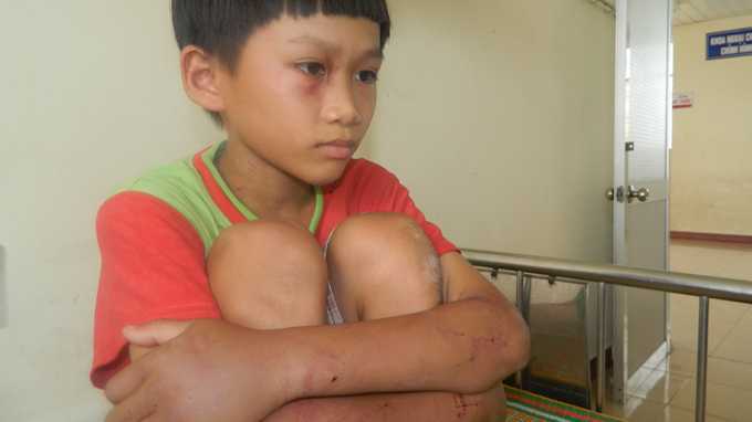 Cha ruột đánh đập, bắt con viết nhật ký 'thù hận' mẹ